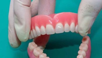protesis-dentales-11